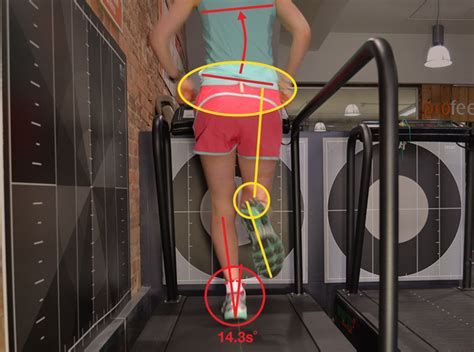 Gait Analysis Can It Help You Central Therapy