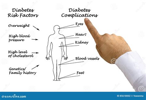 Diabetes Complications Stock Illustration Illustration Of Factor