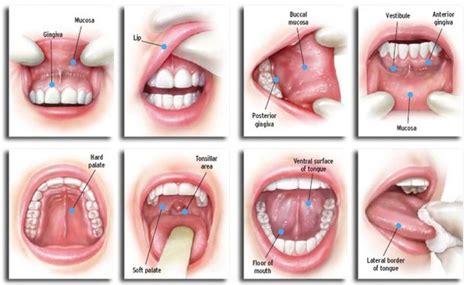 Signs Of Oral Cancer — Emergency Dentist Sydney