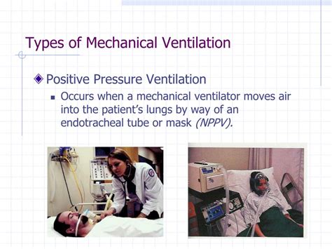 Ppt Principles Of Mechanical Ventilation Powerpoint Presentation