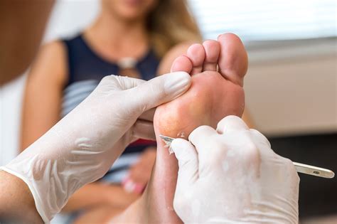 J And J Foot Clinic Leamington Spa Foot Clinic Foot Health Practitioner Foot Care Toenail