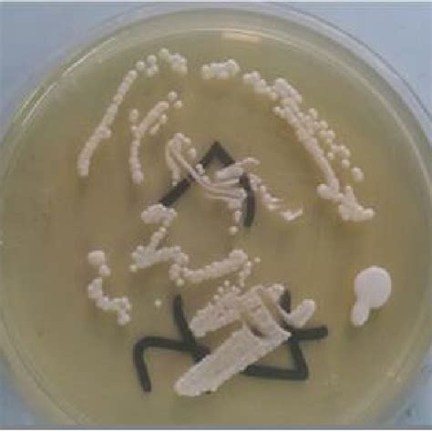 Colonies Of Candida Albicans Cultured On Sabouraud Dextrose Agar At 37