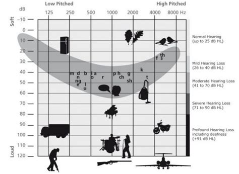 Understanding The Different Levels Of Hearing Loss Davidson Hearing