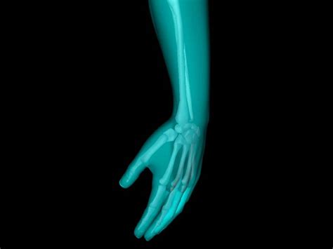 X Ray Hand Medically Accurate 3d Model 3d Model Animated Cgtrader