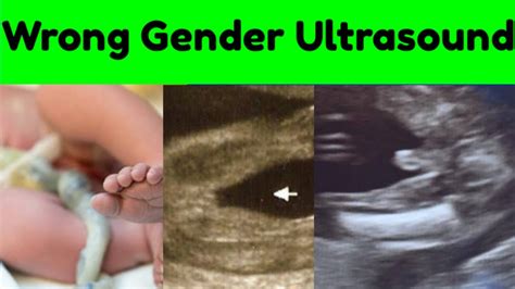 Wrong Gender Ultrasound Youtube