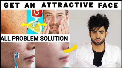 5 Common Skin Problems 5 Easy Solution For Handsome Face हिंदी में Youtube