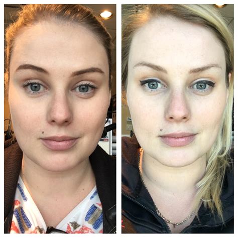 Face Before And After Weight Loss Female Weightlosslook