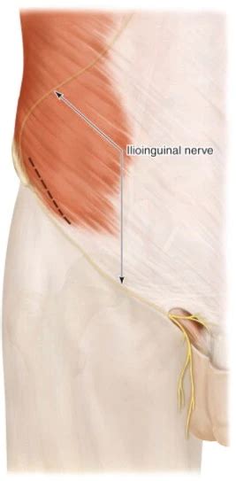 Ilioinguinal Nerve Anatomy Origin Course Branches Function