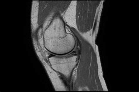 Ortho Dx Anterior Knee Pain Clinical Advisor