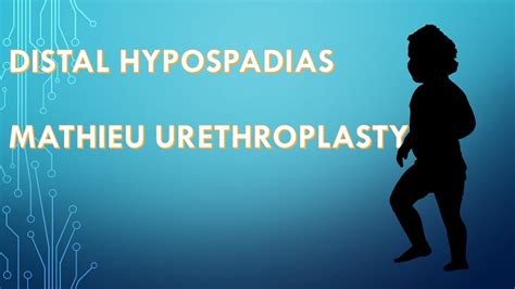 Mathieu Urethroplasty For Distal Hypospadias Youtube