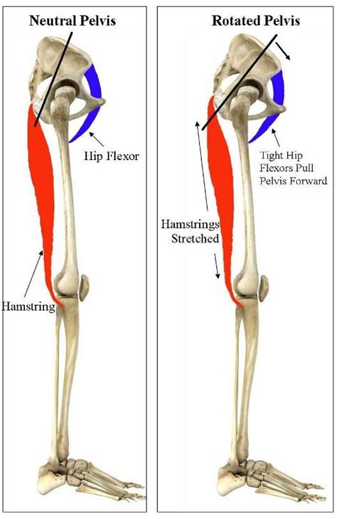 Common causes of tight hip and lower back muscles include injury, too little activity, too much activity and muscular imbalances. Client says, "Brandi, what the heck is 'Neutral Pelvis'?" Images are so much better I told her ...