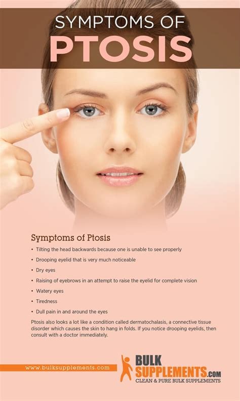 Ptosis Symptoms Causes And Treatment