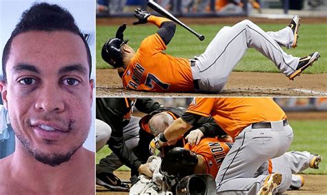 Baseball Player Giancarlo Stanton Releases First Photos Of Injuries