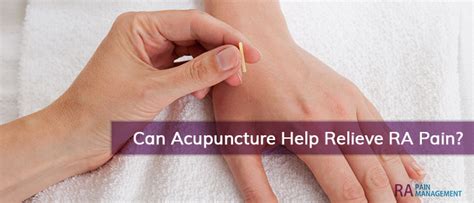 Can Acupuncture Help Relieve Rheumatoid Arthritis Pain