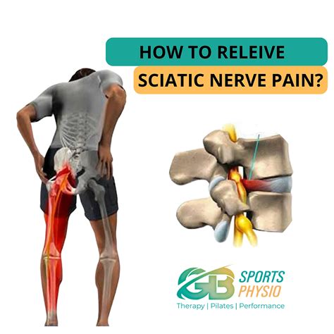 How To Releive Sciatic Nerve Pain