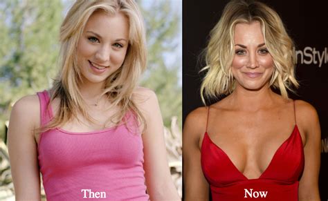 Kaley Cuoco S Impact On The Plastic Surgery Industry Dr Monica Tadros