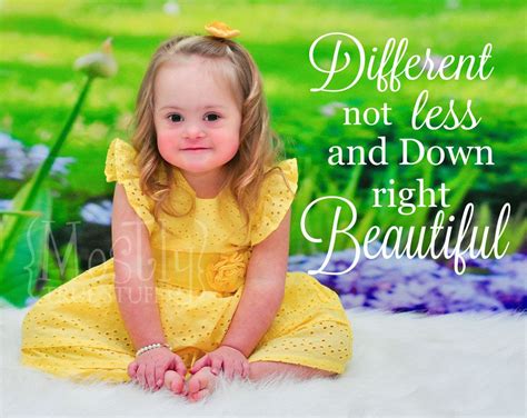 Quotes About Down Syndrome Inspiration