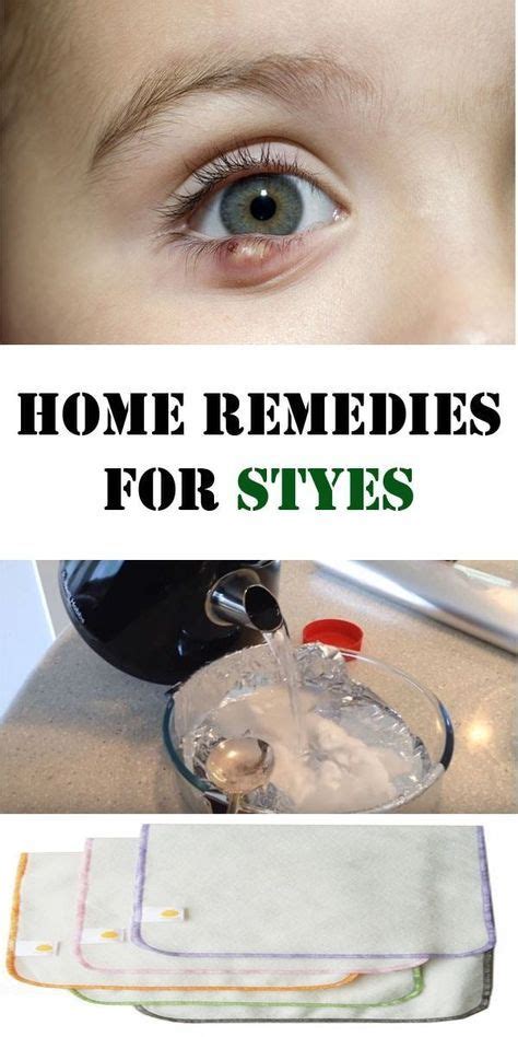 Home Remedies For Styes Remedies Styes