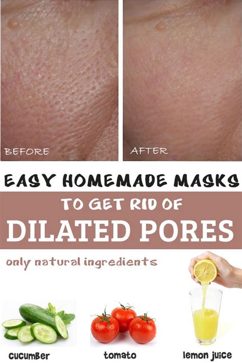 Three Easy Homemade Masks For Dilated Pores Tipps
