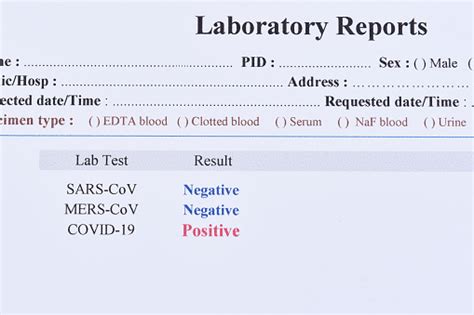 Positive Test Result Of Covid19 Virus Stock Photo Download Image Now