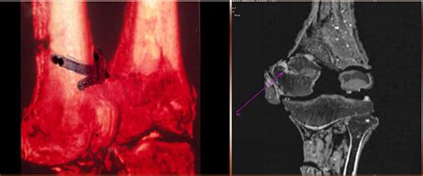 King Tut X Ray And Ct Scan Two Views