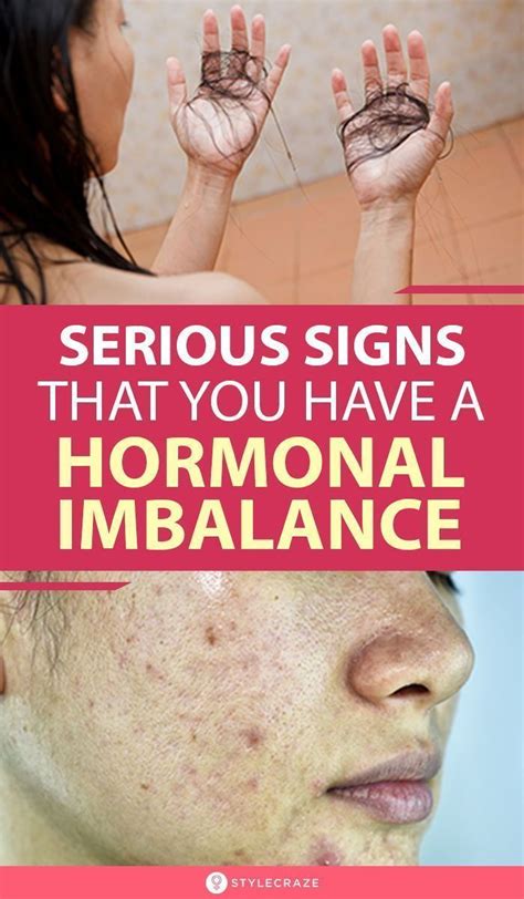 13 Signs That A Person May Have A Hormonal Imbalance In 2021 Hormone Imbalance Female Hormone