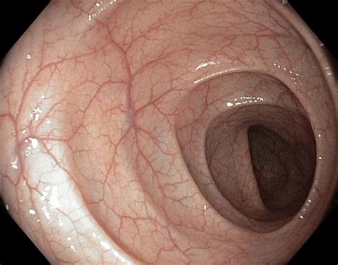 Colon synonyms, colon pronunciation, colon translation, english dictionary definition of colon. Healthy Colon, Large Intestine Photograph by Gastrolab