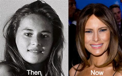 Melania trump, wife of the president of the united states donald, has somewhat changed her image during her time in the limelight. Melania Trump Plastic Surgery Before and After Photos