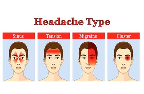 Massage Therapy For Headache Relief Trumedic