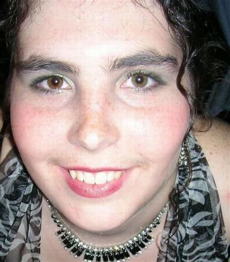 Weird And Ugly Eyebrows 37 Pics