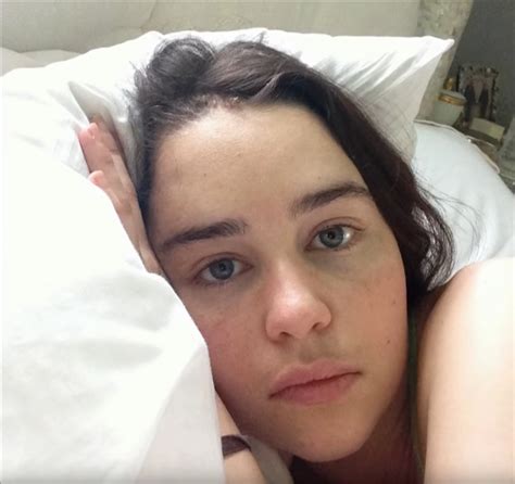 Emilia Clarke Shares More Details Of Her Life Saving Surgery British