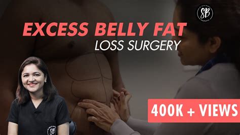 Liposuction Procedure Abdominal Surgery Excess Belly Fat Removal