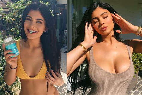 Kylie Jenner Plastic Surgery Before And After Pictures Women In The