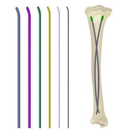 Femoral Intramedullary Nail Health Joy Medical Tibia Fibula Humerus