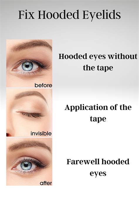How To Fix Hooded Eyes Without Surgery Unugtp News