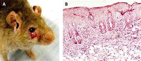 Figure 1 From Recent Findings In Mouse Models For Human Atopic