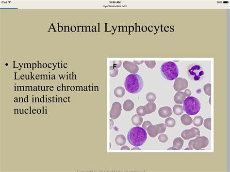 Abnormal Lymphocytes In Hematology