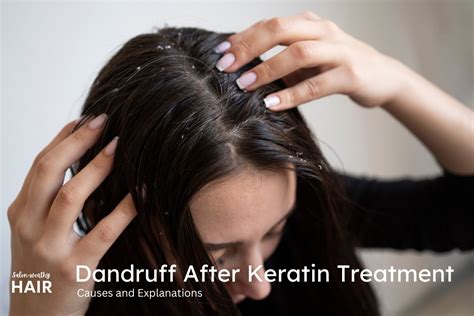 Causes Of Dandruff And Dry Flaky Scalp After Keratin Treatment