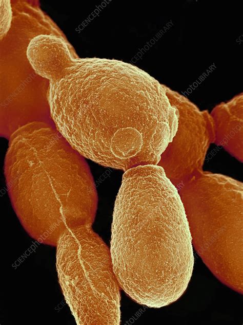 Candida Albicans Yeast Sem Stock Image B2501587 Science Photo