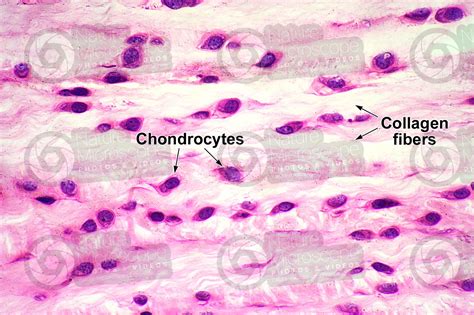 Fibrocartilage