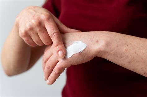 9 causas da dermatite atópica e como combatê las Clinica Croce