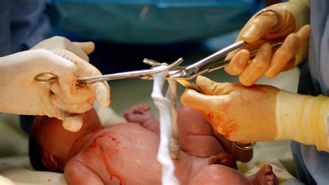 As the time for the baby's birth nears, the umbilical cord carries antibodies from you to your baby, to help the baby ward off infections for the first few months after birth. Cut Umbilical Cord | What to Expect