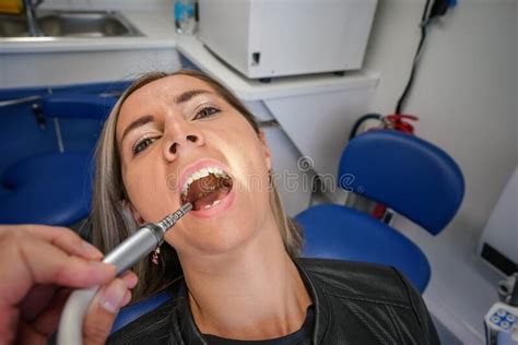 Young Woman Posing With Her Mouth Open At Dentist Chair Dental Tool
