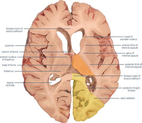 Cross Section Illustration Of The Posterior Brain Brain Anatomy Porn Sex Picture