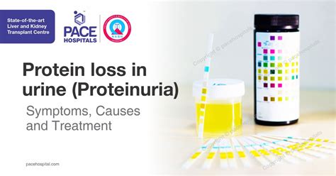 Protein Loss In Urine Proteinuria Symptoms Causes And Treatment