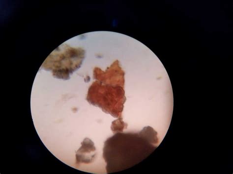 Piperis Nigri Fructus Fnosi Mikroskopis