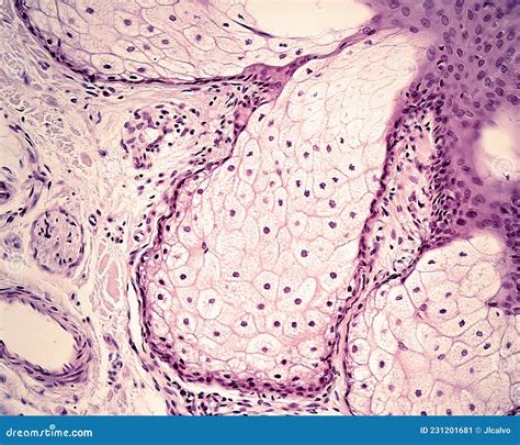 Human Skin Sebaceous Gland Stock Image Image Of Dermis Human 231201681
