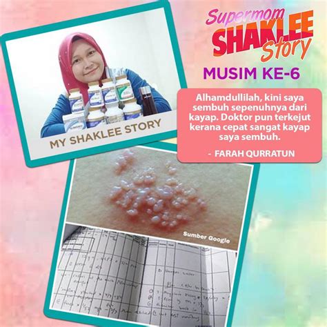 Check spelling or type a new query. Kayap Ketika Hamil : Cara Mengubati dan Mencegah Sakit ...
