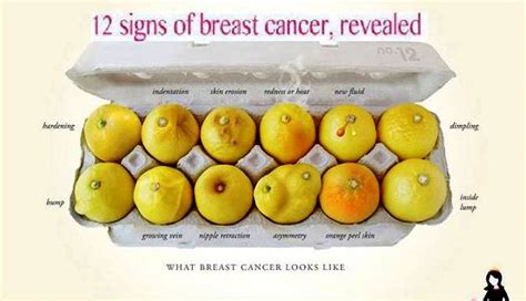 I'm 20 years old and have finally got my life on track. My Health Care: 12 Signs of Breast Cancer Revealed