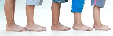 Varicose Veins In Children Do Occur The Whiteley Clinic